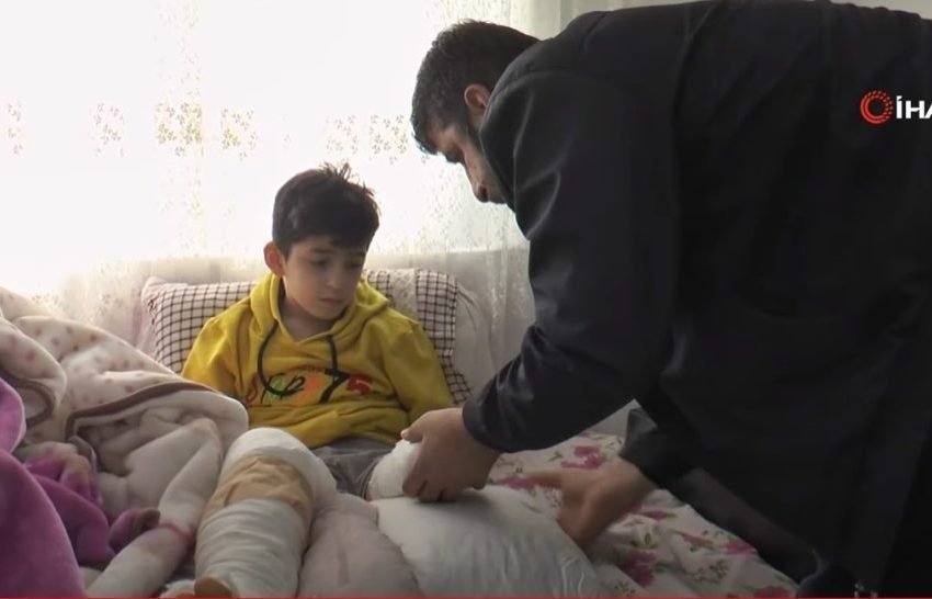  МУ ЈА АМПУТИРАЛЕ ЕДНАТА НОГА, А ДРУГАТА КАКО ДА ЈА НЕМА- 13 годишно момче поминало голгота под урнатините, неговата сестричка засекогаш останала заробена