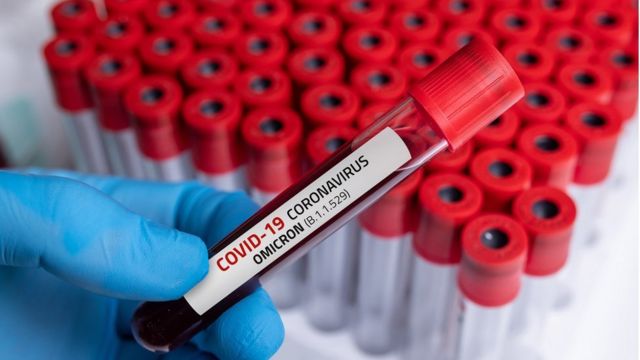  СЗО ги повика САД да споделат податоци за потеклото на коронавирусот