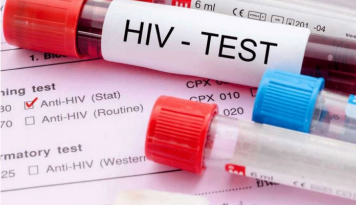  Четири нови случаи на ХИВ и еден на СИДА во Македонија – сите се мажи меѓу 20 и 39 години