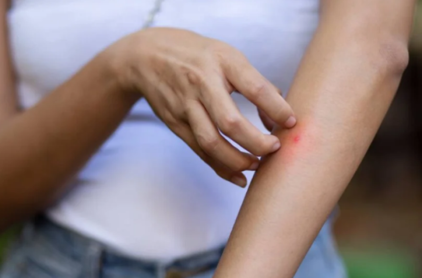 Природен репелент: Комарците не го сакаат мирисот на ова популарно овошје